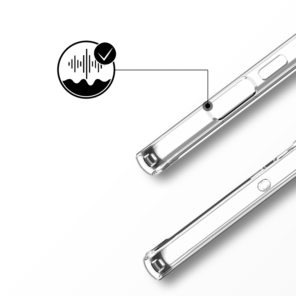 Etui do Xiaomi 14 Pro przeźroczyste, silikonowe Flexi, hologramowe usta - obrazek 6